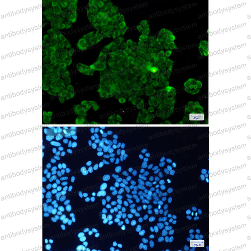 Anti-PPP1CB/PP1C beta Antibody (R2A31)