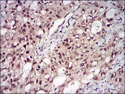 Immunohistochemical for Anti-PPP1CB Antibody (R3P05) ?>