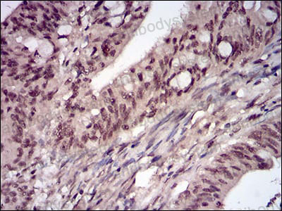 Immunohistochemical for Anti-PPP1CB Antibody (R3P05) ?>