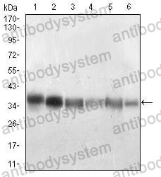 Western blot for Anti-PPP1CB Antibody (R3P05) ?>
