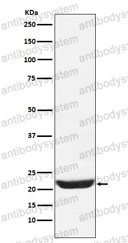 Anti-NCS1 Antibody (R2A32)