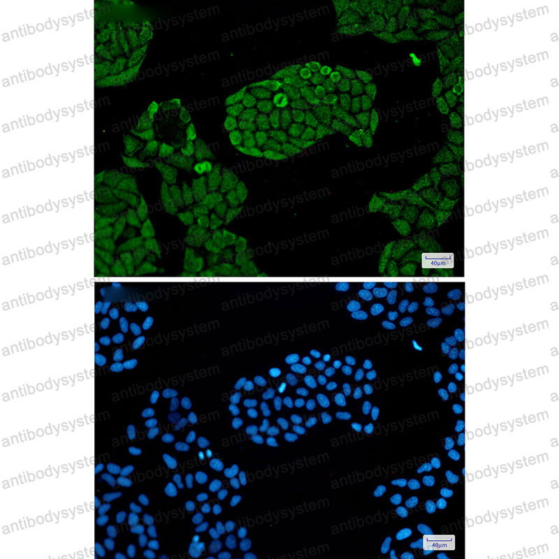Anti-PSMC5 Antibody (R2A34)