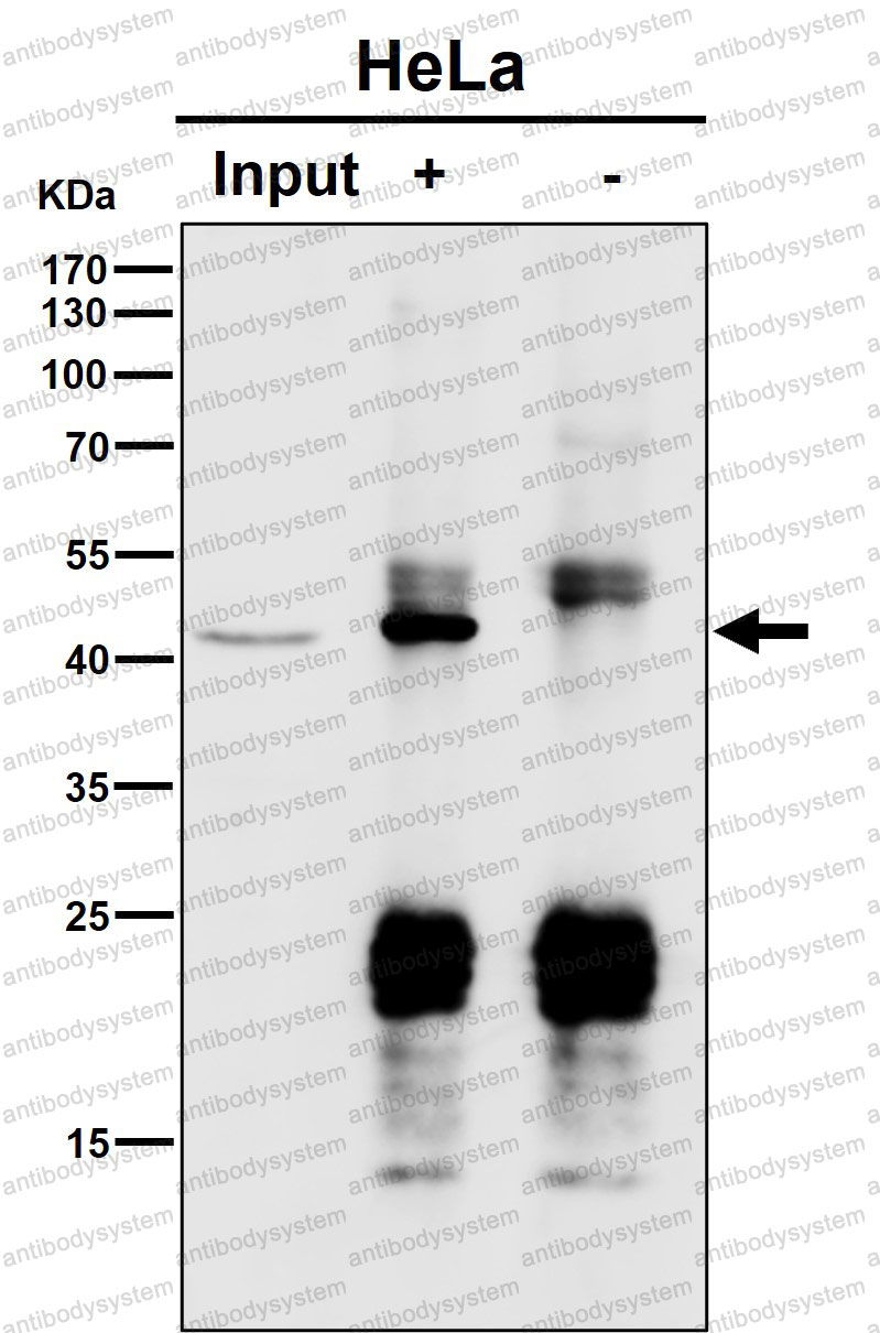 Anti-PSMC5 Antibody (R2A33)