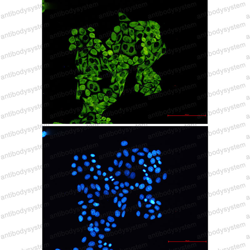 Anti-RPS8 Antibody (R2A36)