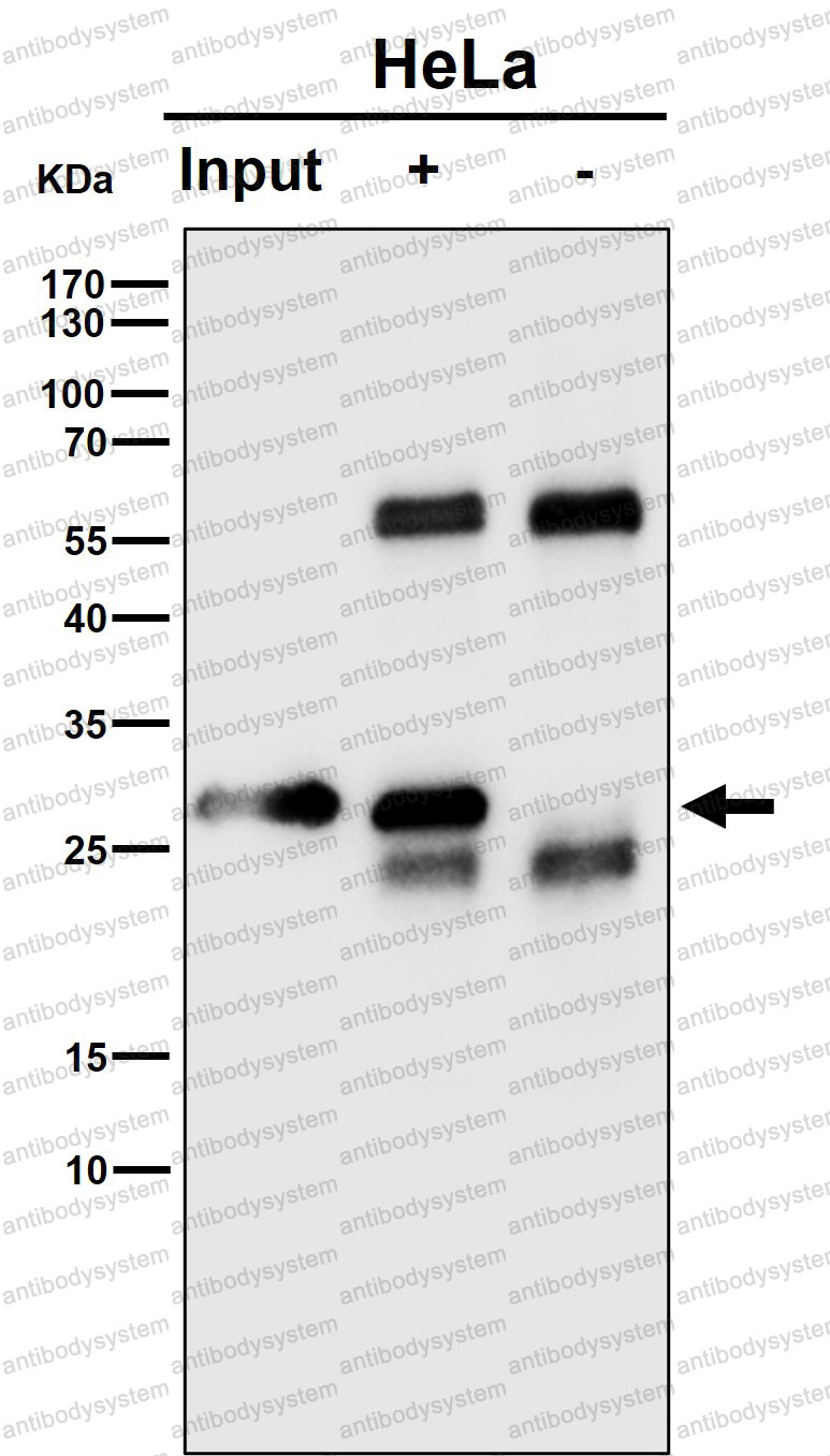 Anti-RPS8 Antibody (R2A35)
