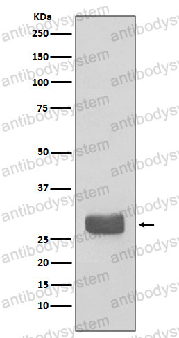 Anti-YWHAE Antibody (R2A37)