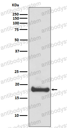 Anti-ARF6 Antibody (R2A39)