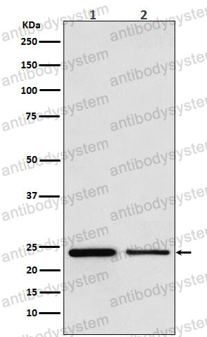 Anti-TBPL1 Antibody (R2A40)