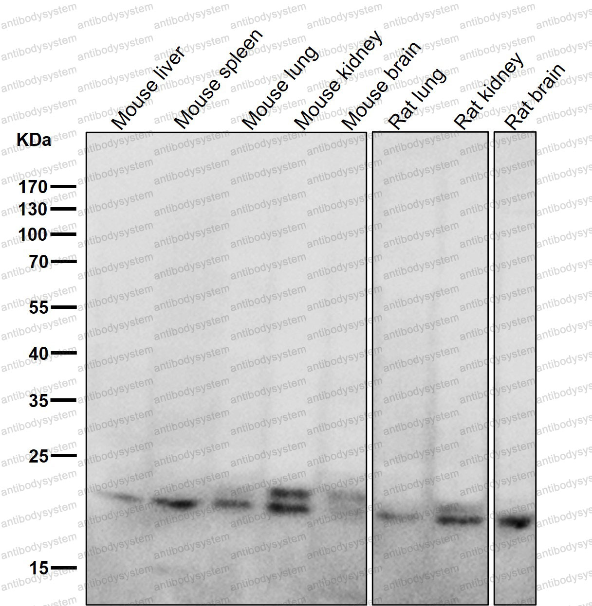 Anti-RAB11A Antibody (R1B22)