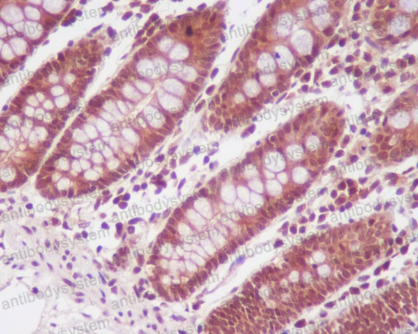 Anti-PP2A alpha+beta Antibody (R1C50)