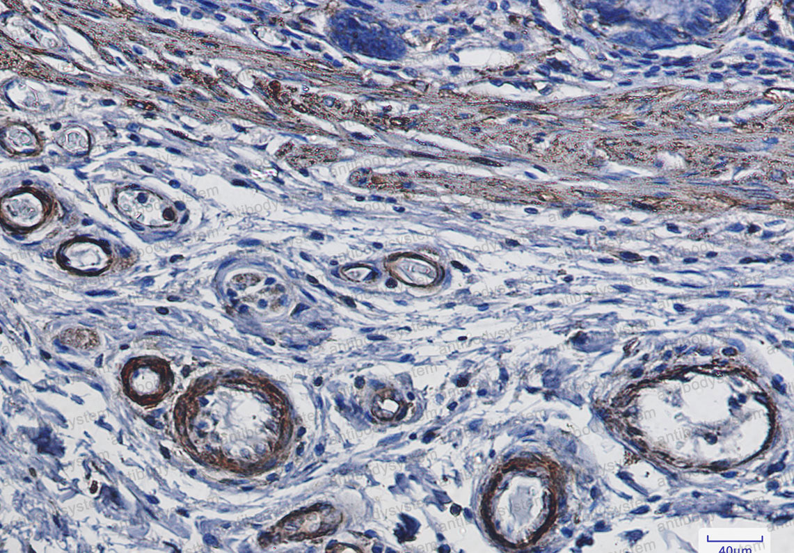 Anti-SMA /ACTA2 Antibody (R2A43)