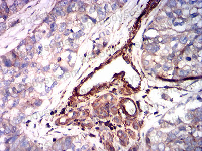 Immunohistochemical for Anti-SMA/ACTA2 Antibody (R3P13) ?>