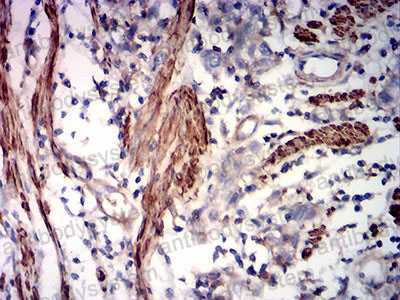 Immunohistochemical for Anti-SMA/ACTA2 Antibody (R3P13) ?>