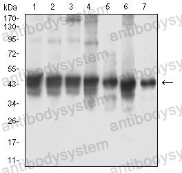 Western blot for Anti-SMA/ACTA2 Antibody (R3P13) ?>