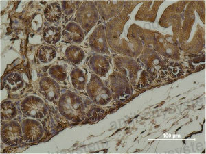 Anti-SMA/ACTA2 Antibody (R3P15)
