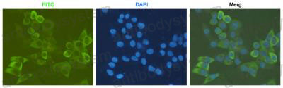 Anti-RPS6 Antibody (R2A44)