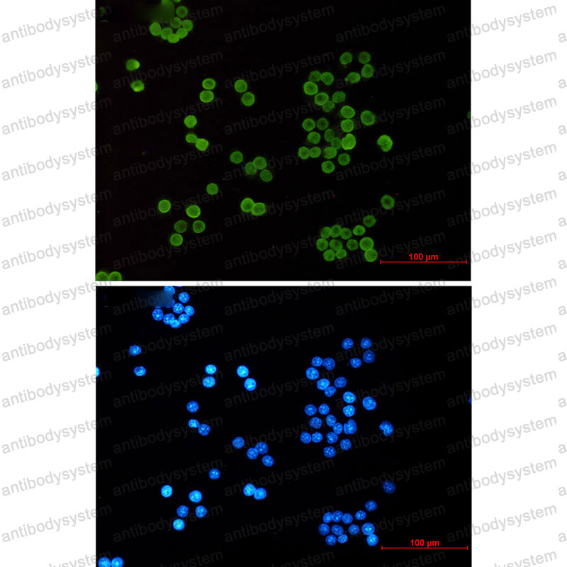 Anti-Acetyl-Histone H4 (Lys5) Antibody (R2A45)