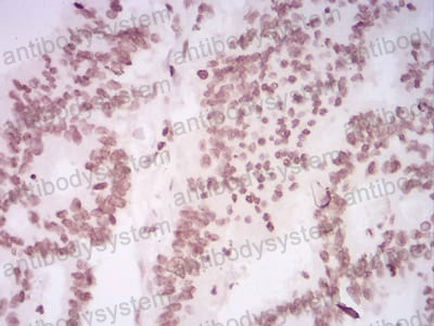 Immunohistochemical for Anti-HIST2H4A (20Me) Antibody (R3P17) ?>
