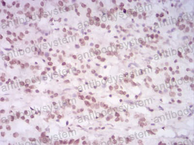 Immunohistochemical for Anti-HIST2H4A (20Me) Antibody (R3P17) ?>
