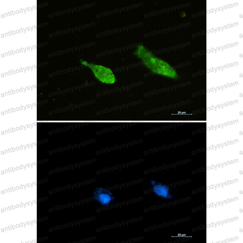 Anti-RAN Antibody (R2A47)