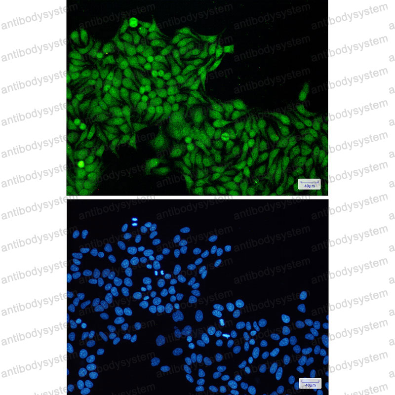 Anti-RBX1 Antibody (R2A49)