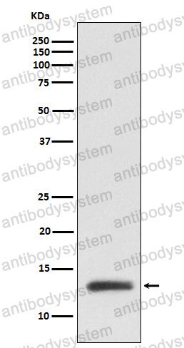 Anti-RBX1 Antibody (R2A48)
