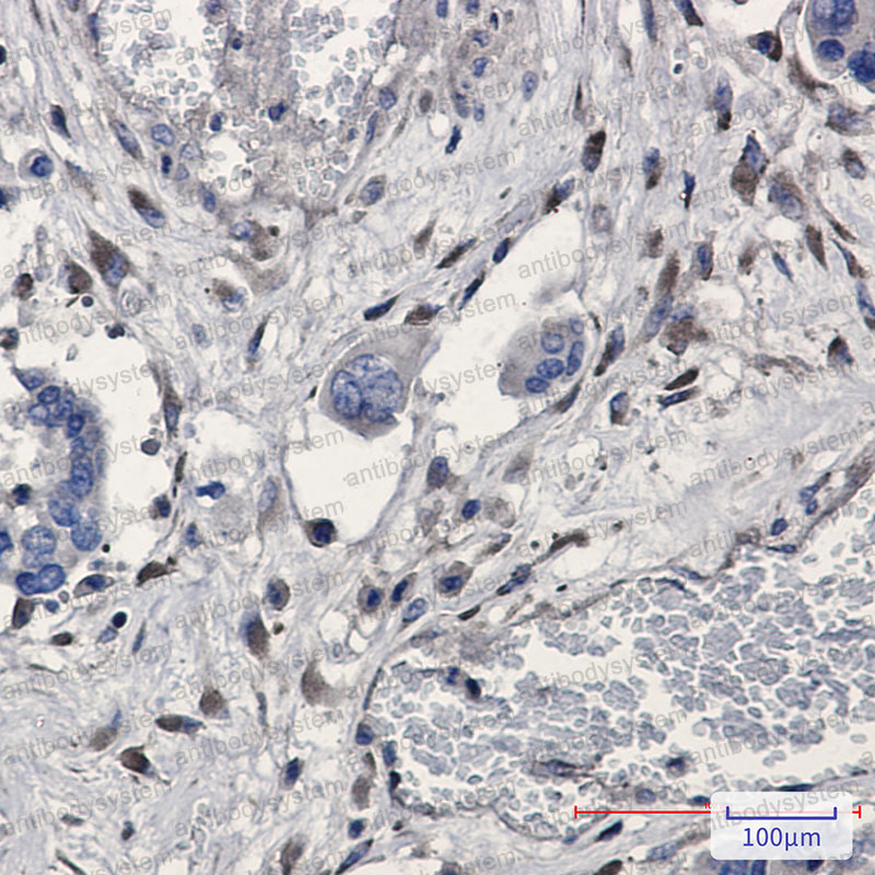 Anti-GNB2 Antibody (R2A51)