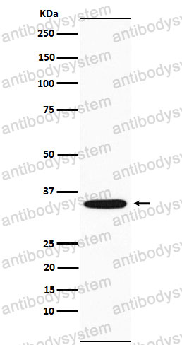 Anti-GNB2 Antibody (R2A50)