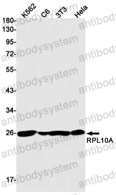 Anti-RPL10A Antibody (R2A53)