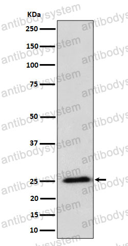 Anti-RPL10A Antibody (R2A52)