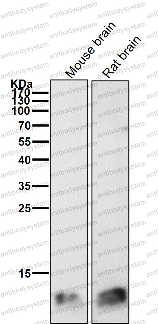 Anti-FKBP1A Antibody (R2A55)