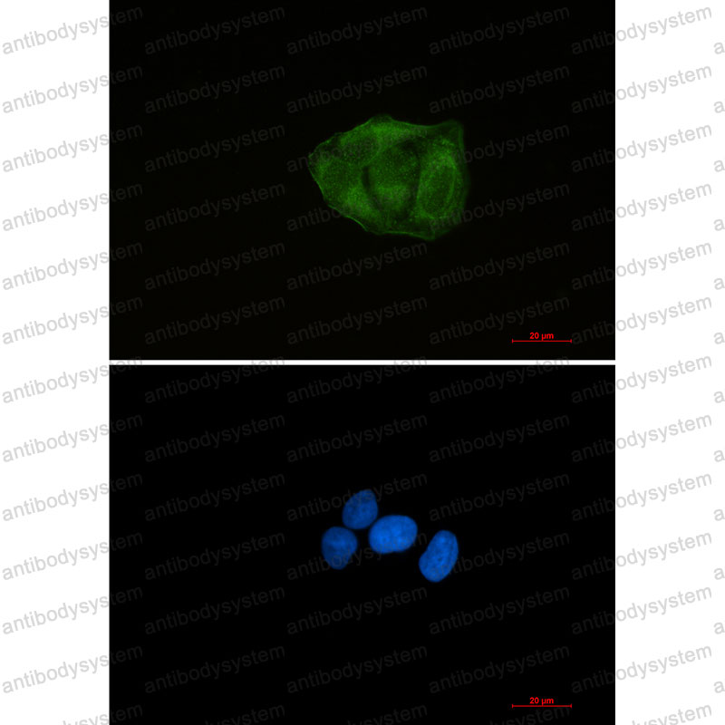 Anti-UBA52 Antibody (R2A57)