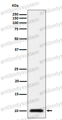 Anti-UBA52 Antibody (R2A56)