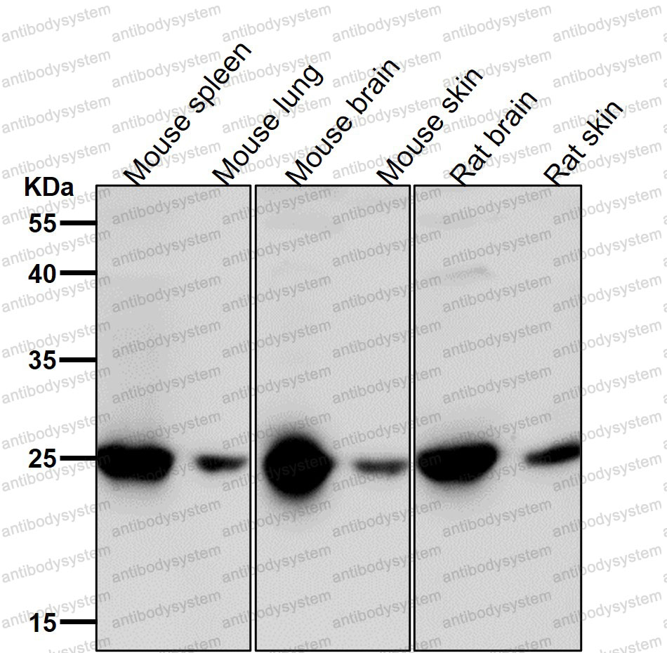 Anti-GRB2 Antibody (R2A59)