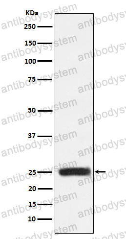 Anti-GRB2 Antibody (R2A58)