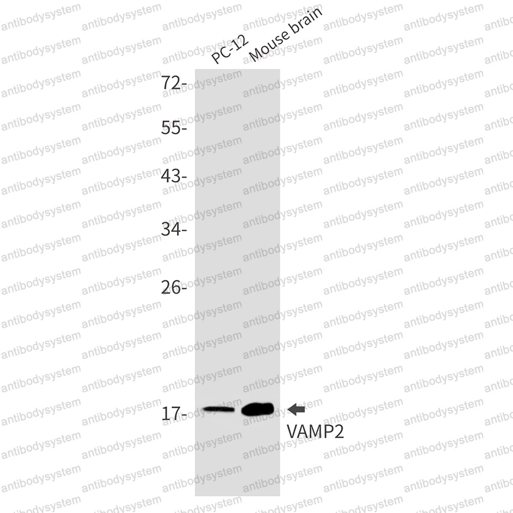 Anti-VAMP2 Antibody (R2A62)