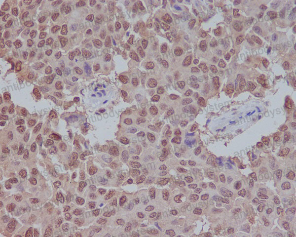 Anti-SUMO1 Antibody (R1A98)