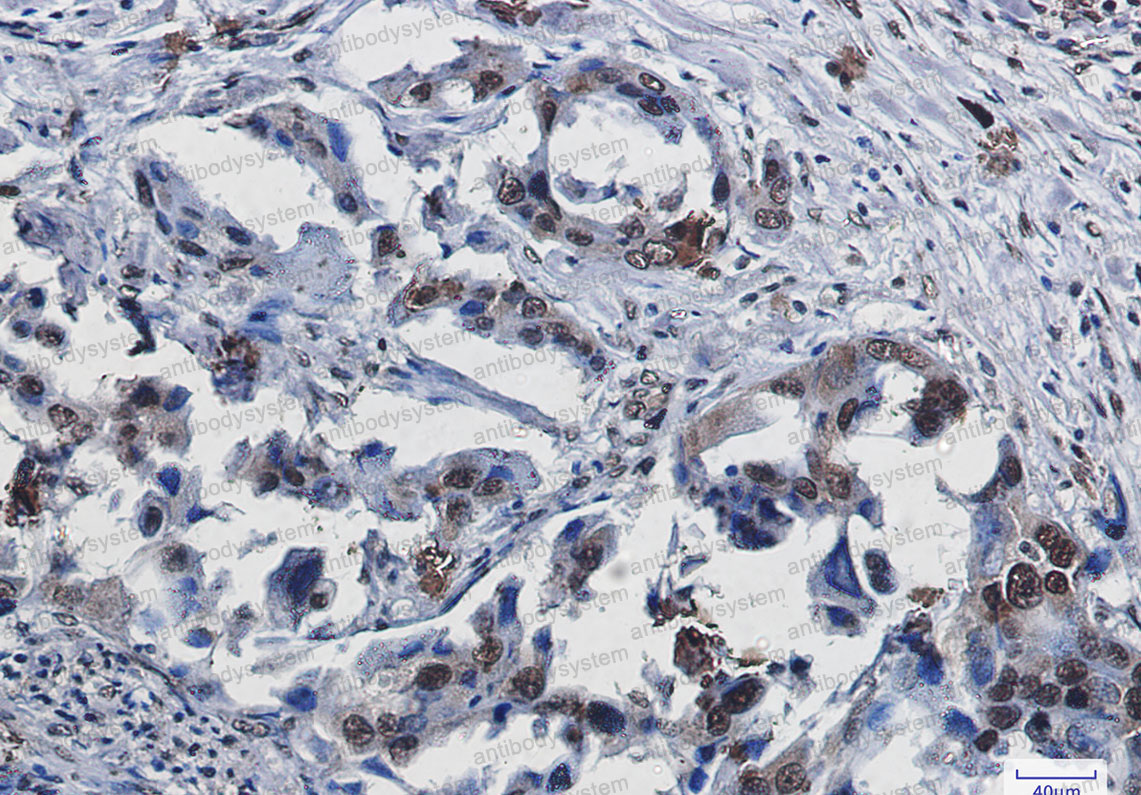 Anti-SUMO1 Antibody (R2A64)