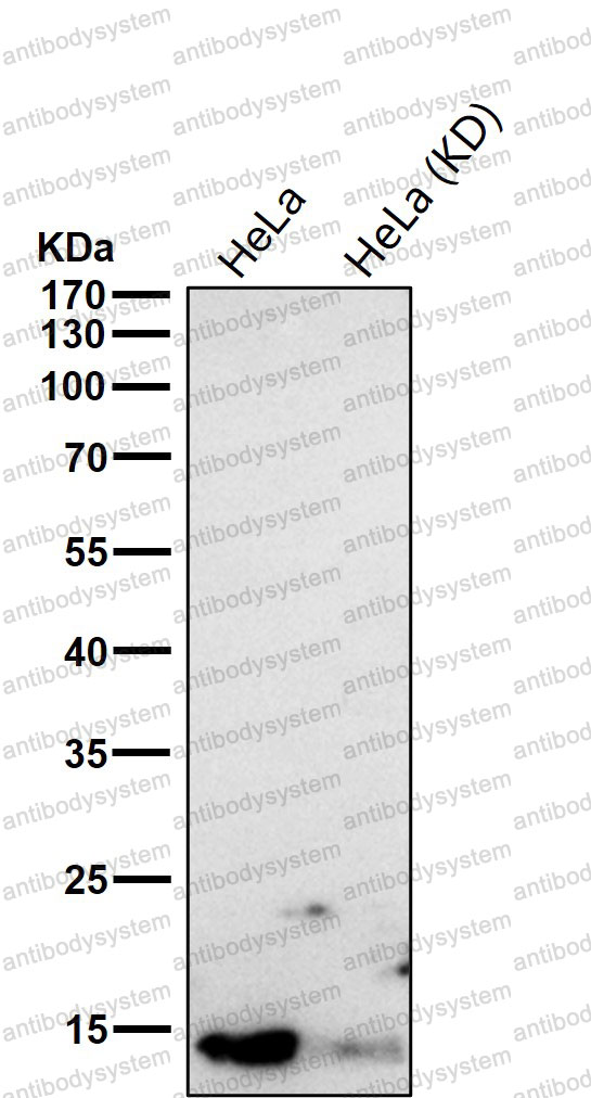 Anti-DYNLL1 Antibody (R1C52)