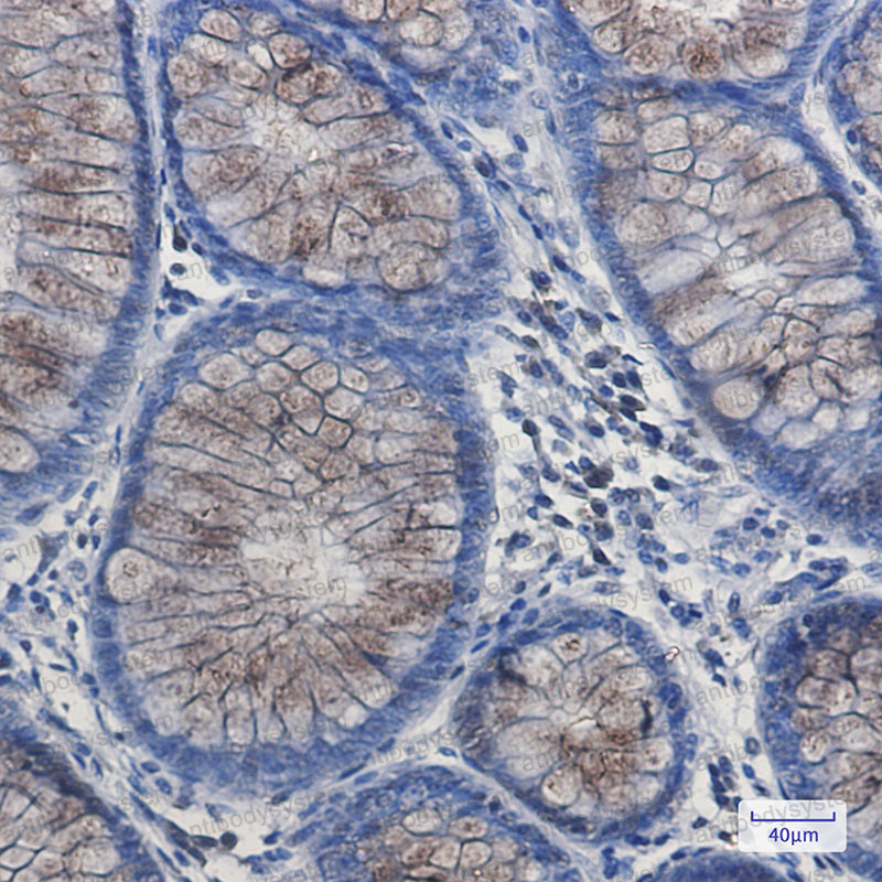 Anti-DYNLL1 Antibody (R2A65)