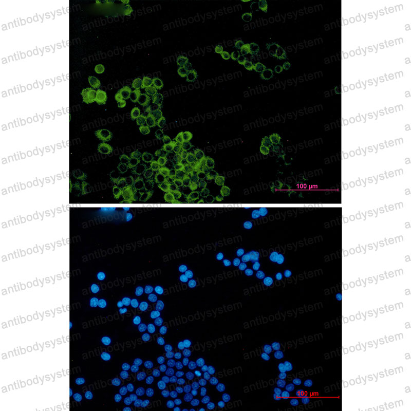 Anti-DYNLT1 Antibody (R2A67)