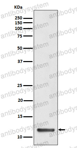 Anti-DYNLT1 Antibody (R2A66)