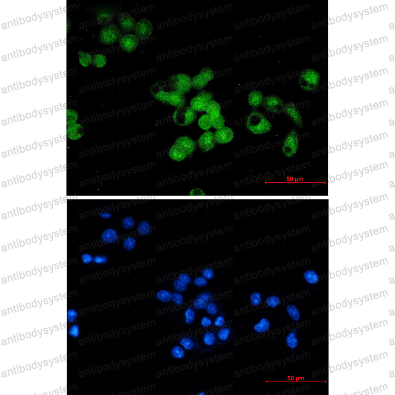 Anti-SKP1 Antibody (R2A68)