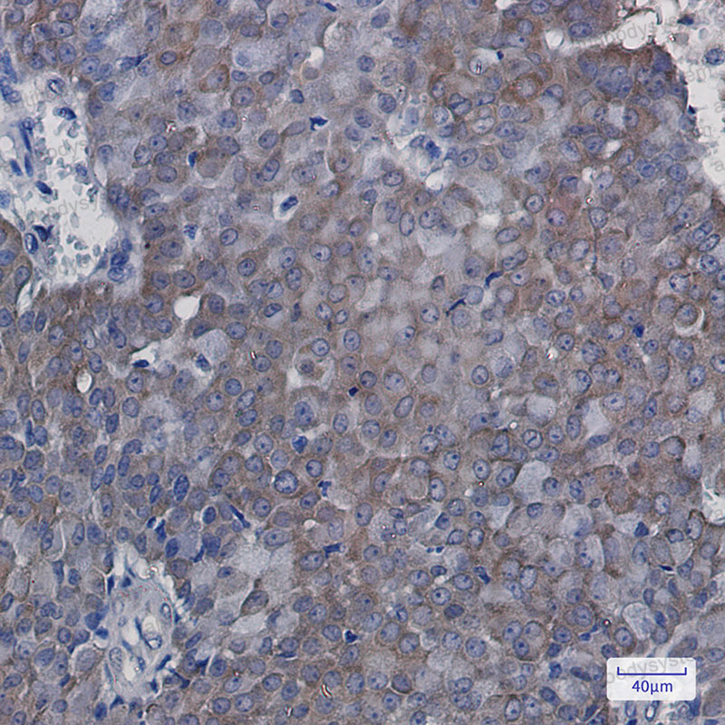 Anti-EIF5A Antibody (R2A69)