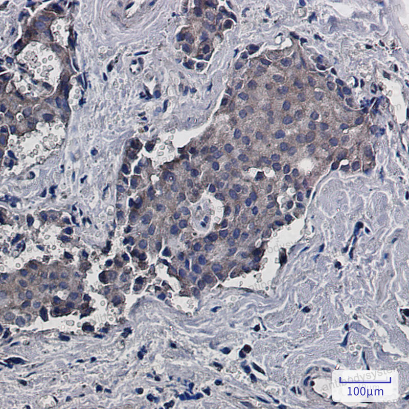 Anti-RACK1 Antibody (R2A71)