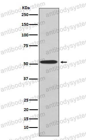 Anti-KCNJ2 Antibody (R2A72)