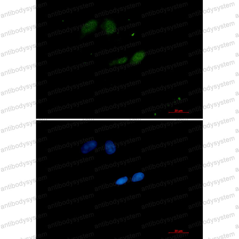 Anti-UBE2I/UBC9 Antibody (R2A73)