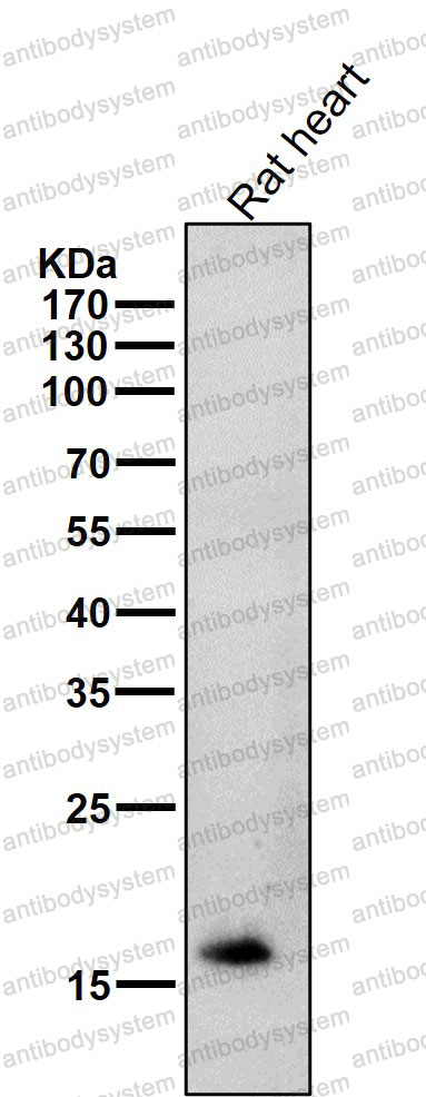 Anti-TNNC1 Antibody (R2A74)