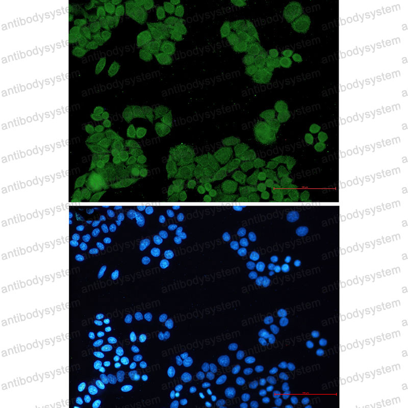 Anti-PP2A alpha/beta Antibody (R2A75)