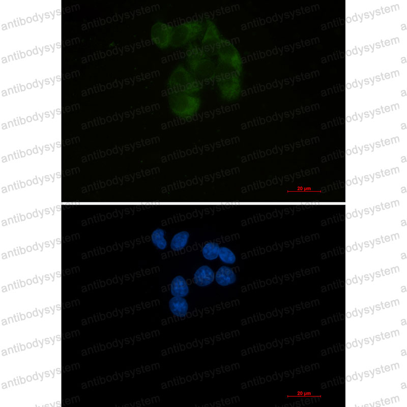 Anti-YBX1 Antibody (R2A76)